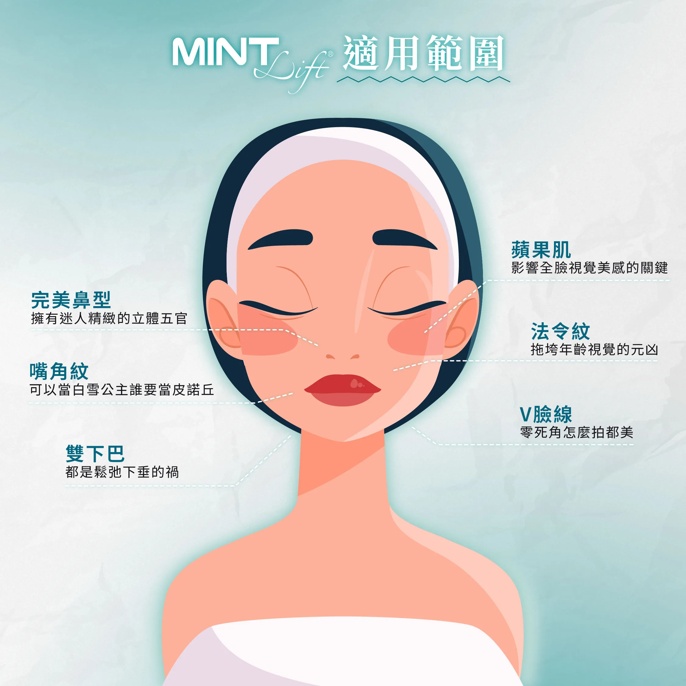 神力拉提,埋線,線雕,拉提