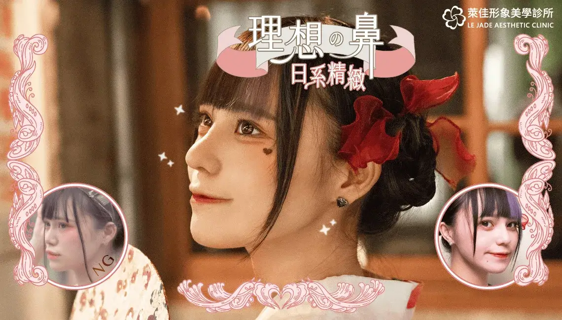【Goretex隆⿐+⽿軟骨墊⿐頭+縮⿐翼⼿術】Coser齋齋打造精緻⽇系美⿐分享!