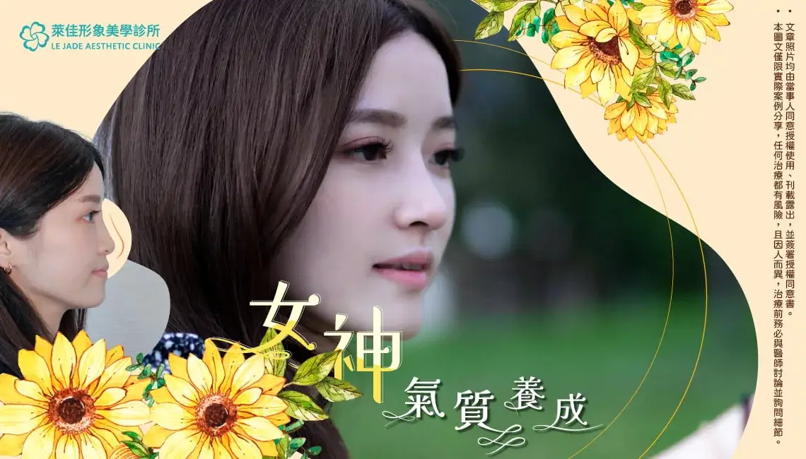 【隆鼻重修】從玻尿酸到Goretex複合式隆鼻手術,我的變美之路案例分享!