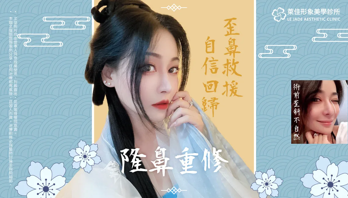 【隆鼻重修】二次隆鼻失敗變歪鼻，許英哲醫師隆鼻重修案例心得