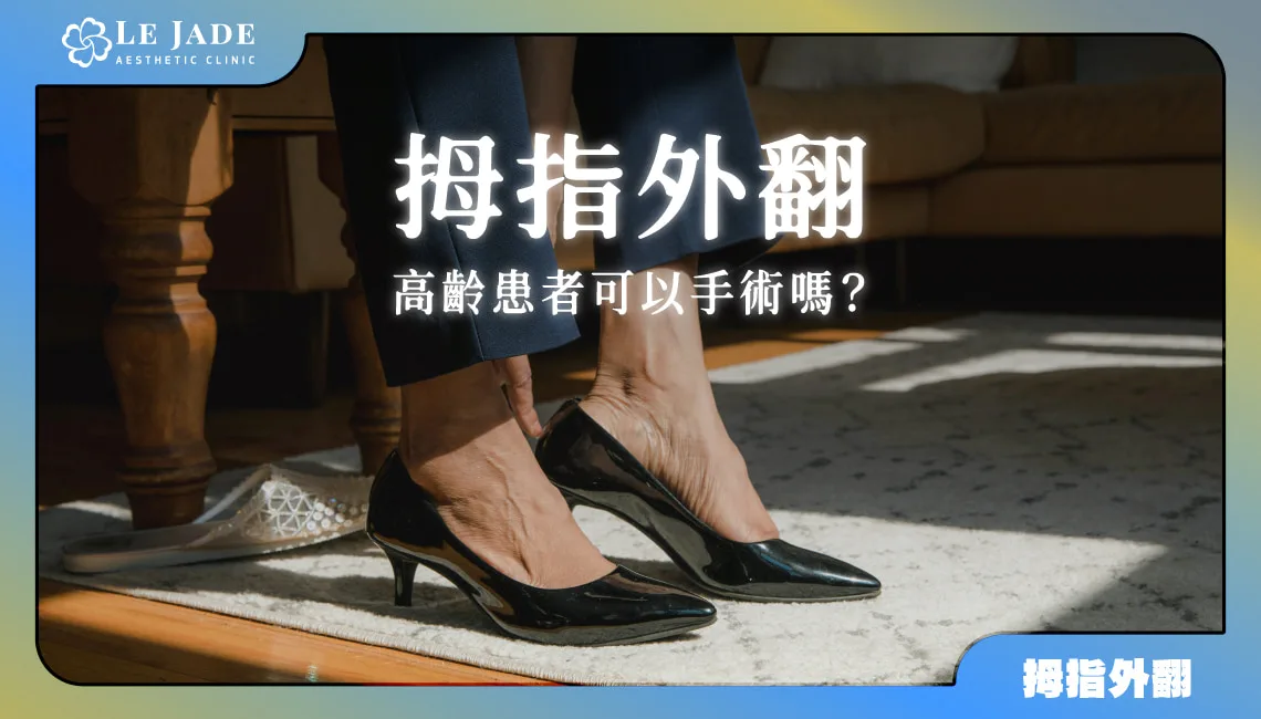 高齡患者可以做拇指外翻手術嗎？讓長輩輕鬆開刀的新式拇指外翻微創手術