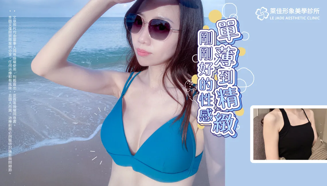 【隆乳推薦】隆乳術後半年全紀錄，Motiva魔滴2.0隆乳案例分享