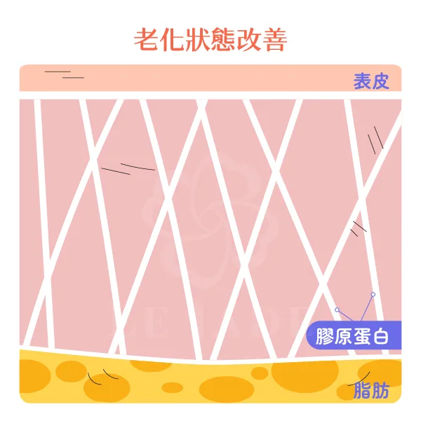 鳳凰電波