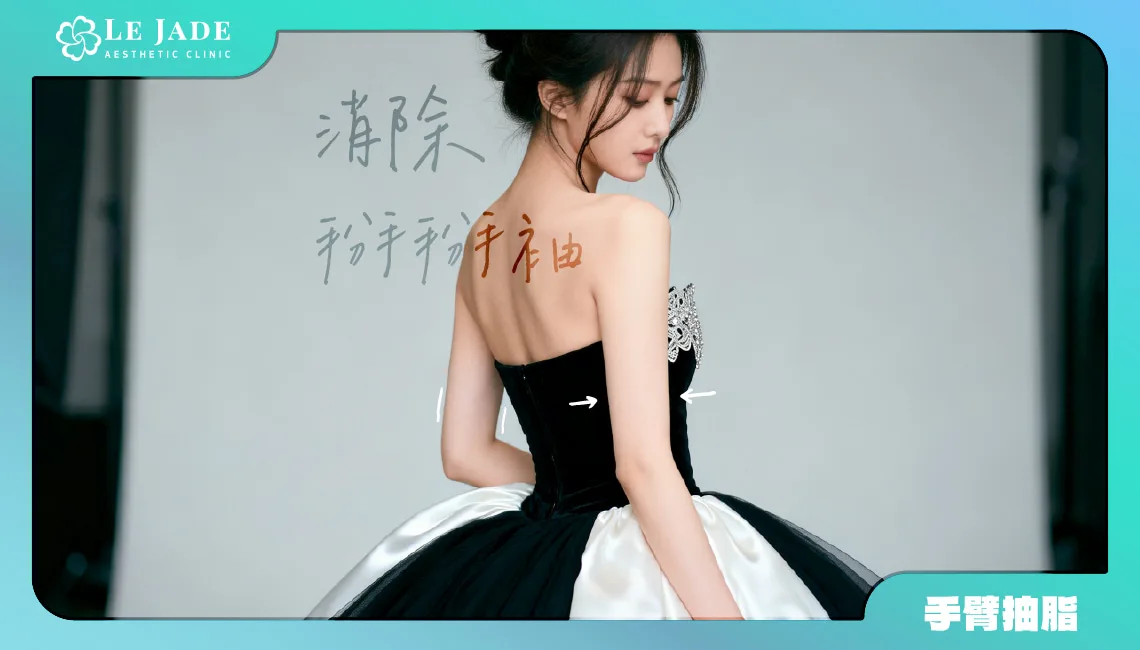 瘦蝴蝶袖最快的方法是什麼？3大招消除掰掰袖，讓手臂線條更緊實！