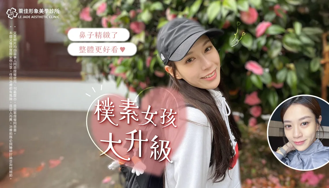 post id 2881 photo