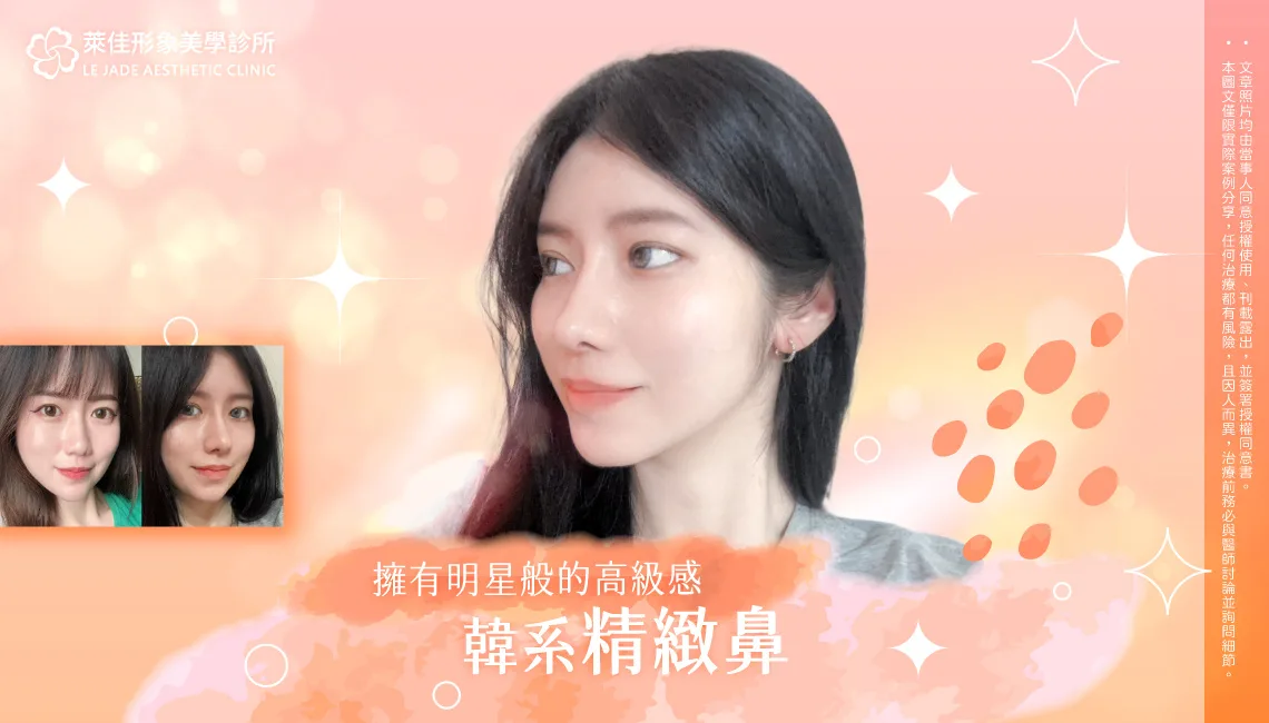 【Goretex隆鼻+自體耳軟骨鼻頭+縮鼻翼手術】韓系精緻鼻，打造立體自然的五官