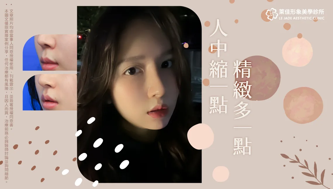 【縮人中+人中窩加深】人中縮一點，精緻多一點，縮人中手術心得分享