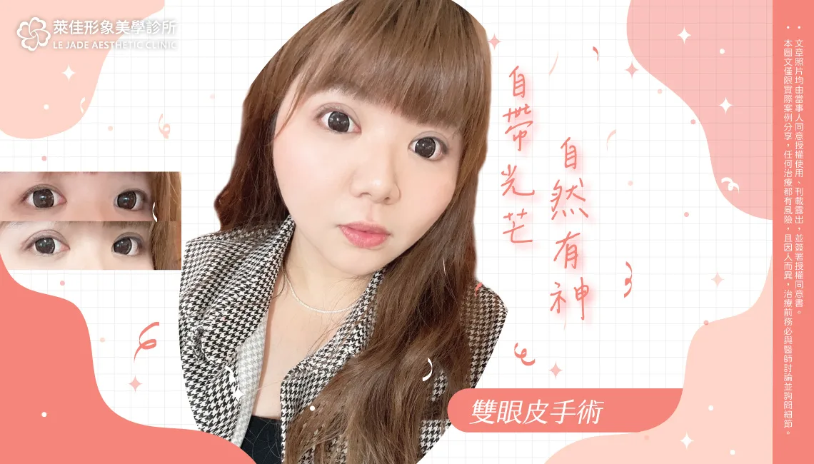 【雙眼皮手術】揮別內雙泡泡眼，打造自然有神的明亮雙眼