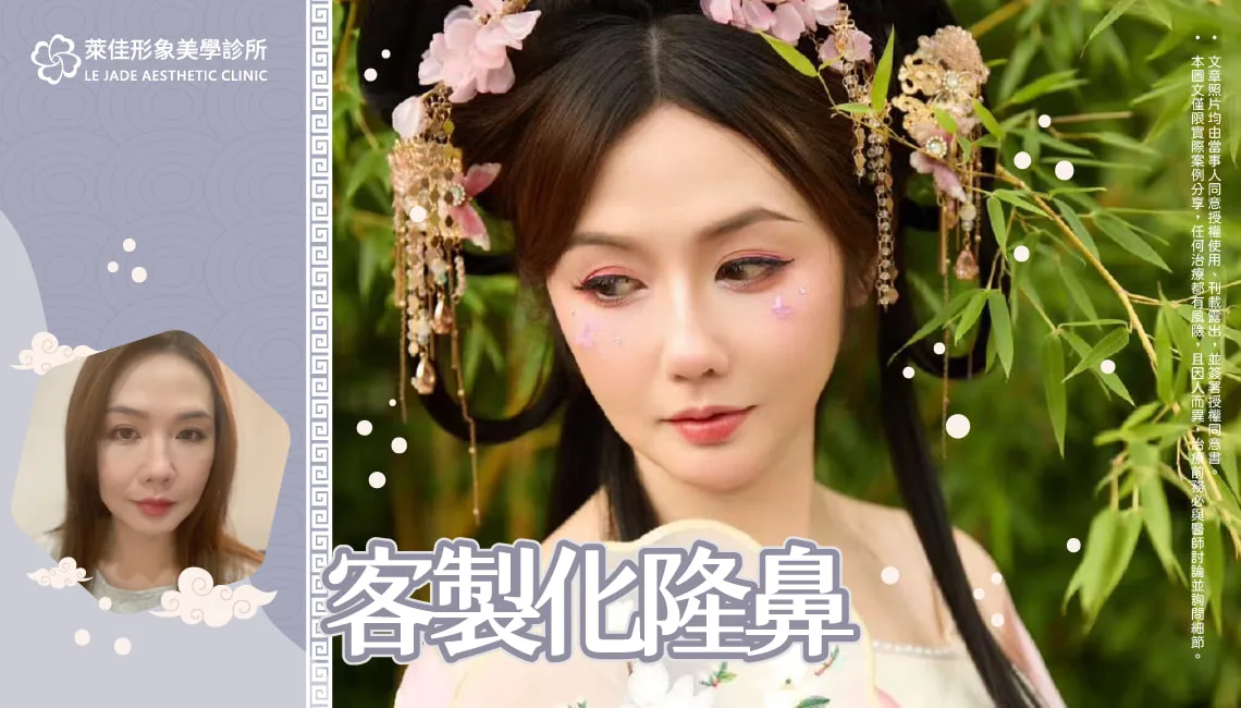 【3D列印完形美隆鼻+肋骨隆鼻】打造高挺鼻樑隆鼻分享