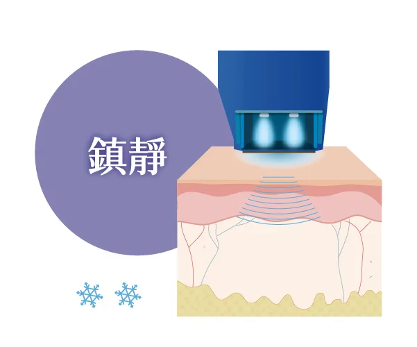 十蓓電波冷卻系統術後鎮靜
