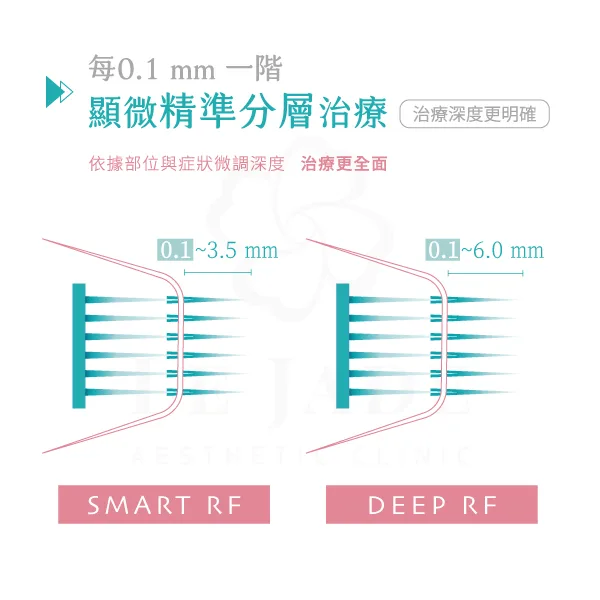 神比微針的精準分層治療