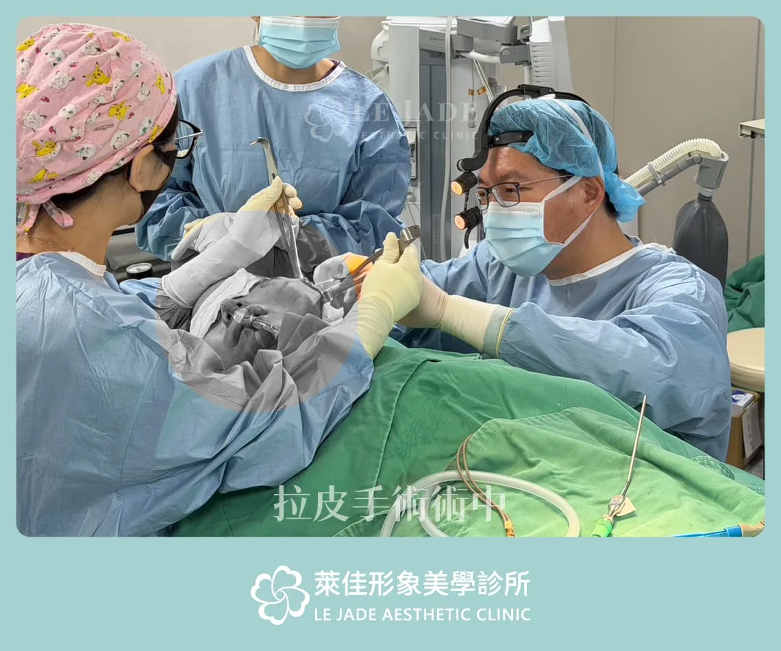 萊佳中下臉拉皮手術進行中紀錄照片