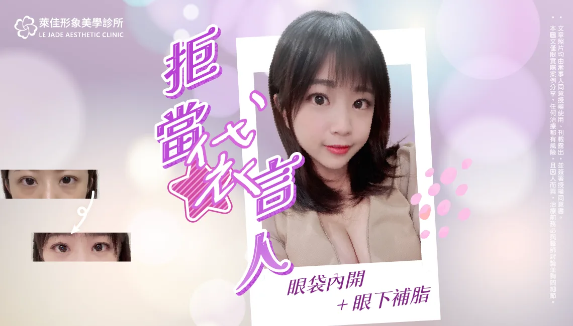 【眼袋內開手術+眼下補脂】改善顯老眼袋，找回晶亮神態，眼袋內開手術案例分享