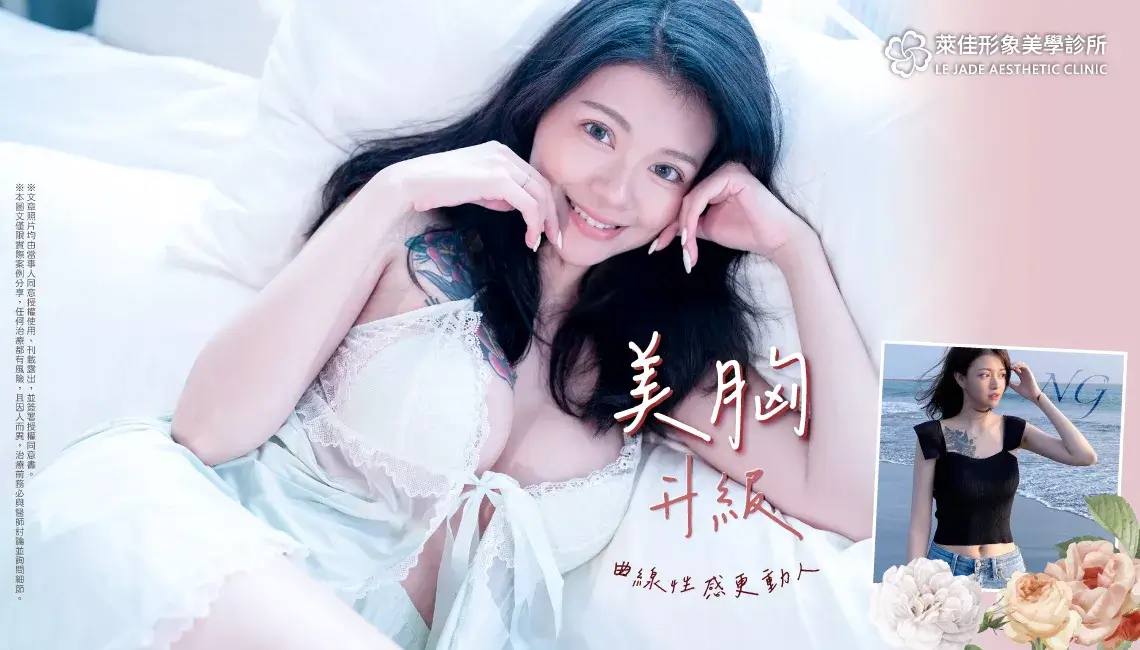 【隆乳推薦】提乳手術+女王波案例分享,胸部下垂及罩杯大小一次改善
