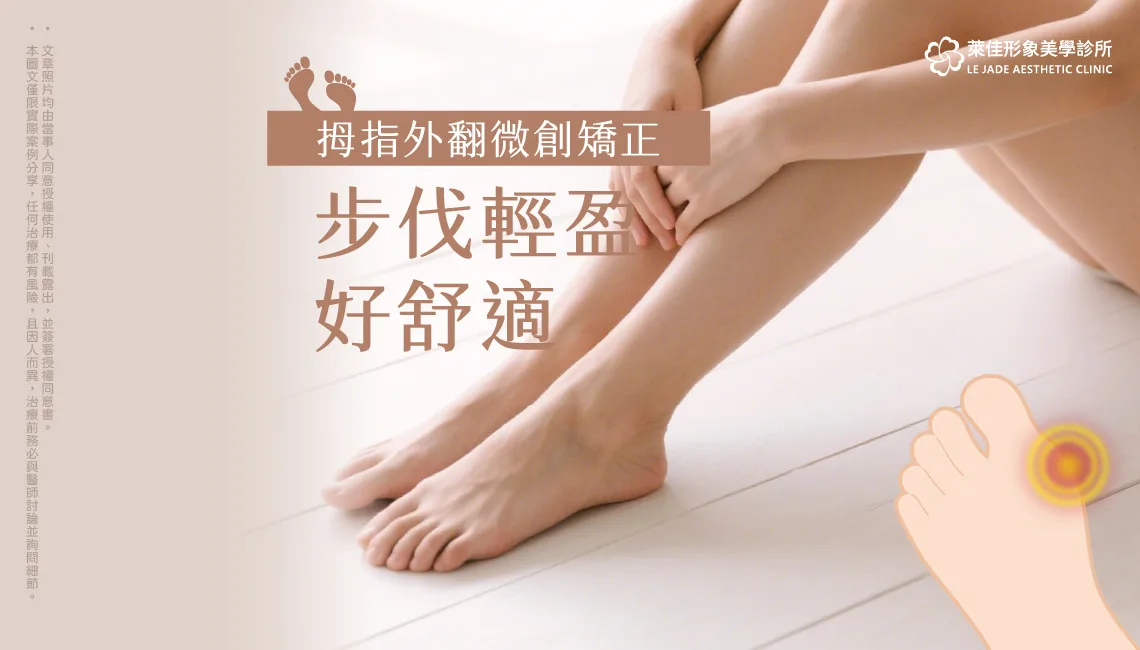 【拇指外翻手術】讓75歲阿嬤開心走路！新式微創拇指外翻手術心得分享