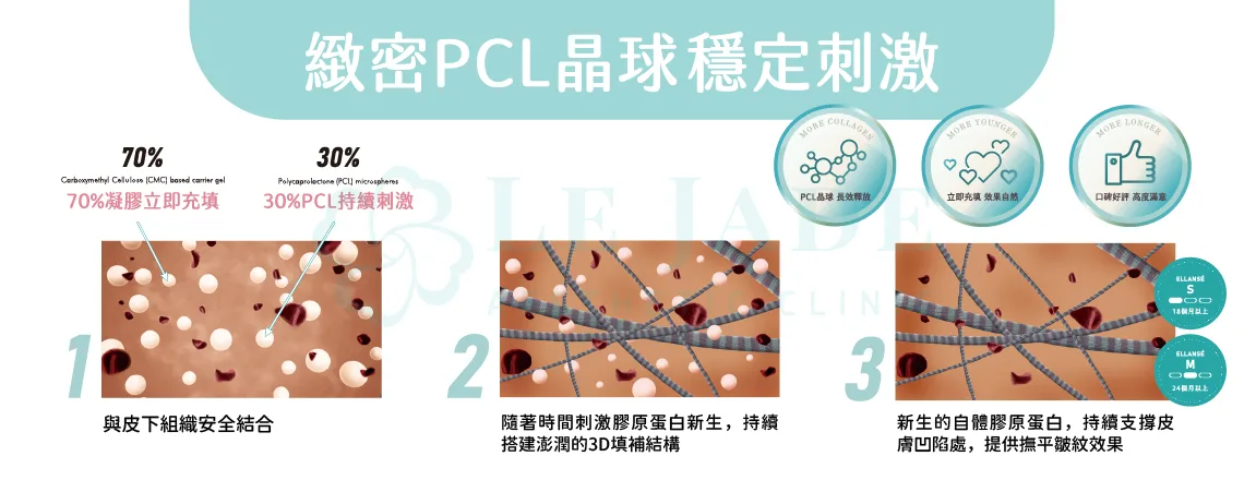 ”洢蓮絲,少女針,什麼是膠原蛋白增生劑,洢蓮絲的效果維持時間,什麼是少女針"