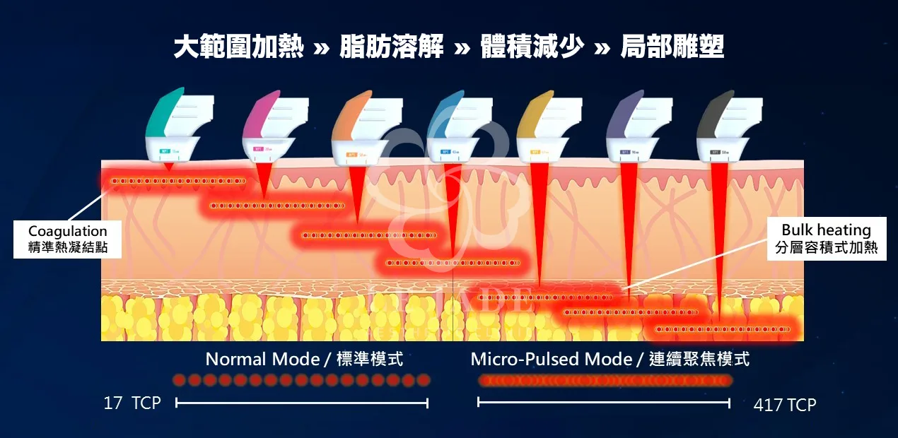 海芙音波,海芙音波第四代,音波拉提,媚必提 高雄