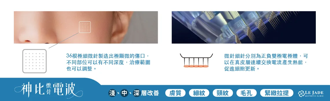 神比微針,微針電波,電波