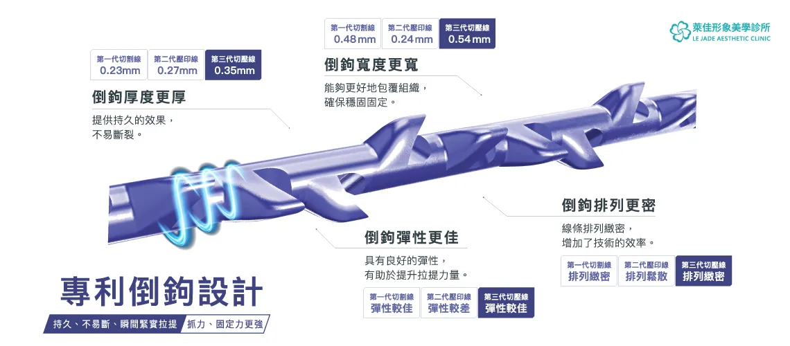 ”提美拉,美特拉,美特拉埋線,美特拉醫美,美特拉線材,美特拉埋線拉提,提美拉線雕,提美拉是什麼線"