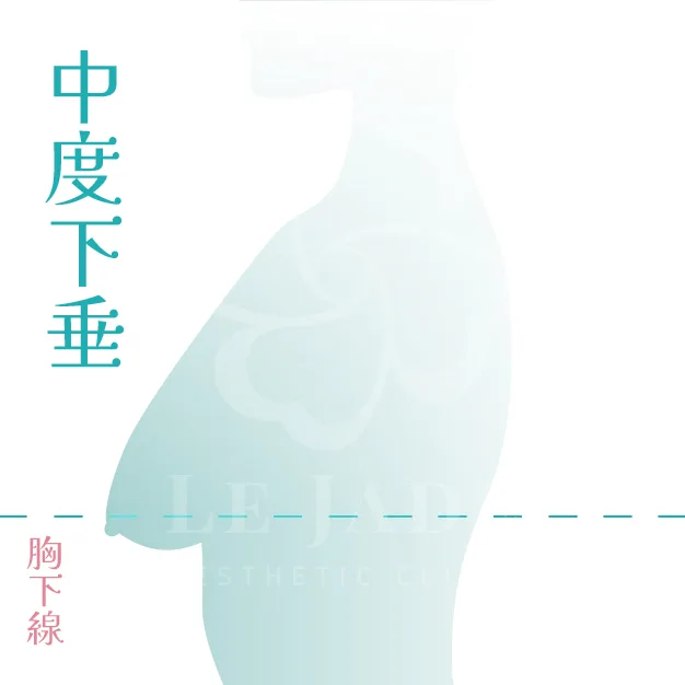 產後胸部下垂,產後胸部下垂怎麼辦,產後胸部下垂運動,產後胸部變小如何恢復,產後胸部下垂按摩,產后胸部下垂醫美