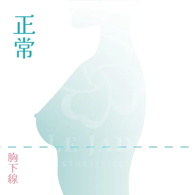 產後胸部下垂,產後胸部下垂怎麼辦,產後胸部下垂運動,產後胸部變小如何恢復,產後胸部下垂按摩,產后胸部下垂醫美