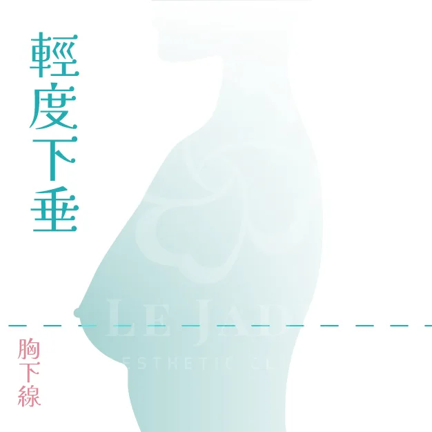 產後胸部下垂,產後胸部下垂怎麼辦,產後胸部下垂運動,產後胸部變小如何恢復,產後胸部下垂按摩,產后胸部下垂醫美