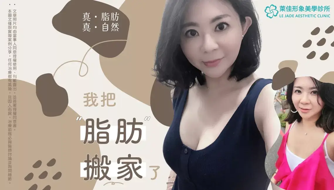 【隆乳推薦】威塑⾃體脂肪隆乳案例分享,瘦⾝、豐胸⼀次完成!