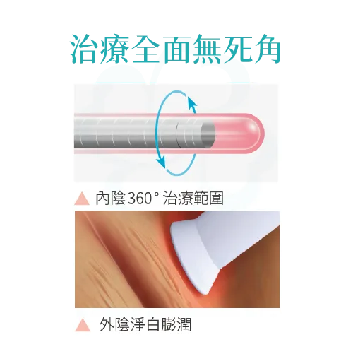 菲蜜莉,菲蜜莉雷射,菲蜜莉雷射蝴蝶電波,菲蜜莉雷射蒙娜麗莎,菲蜜莉雷射美白,私密雷射