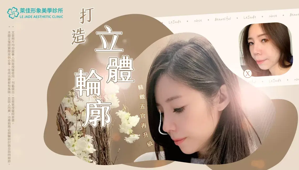 【隆鼻重修】隆鼻攣縮導致鼻孔外露,二次重修再製自然美鼻分享