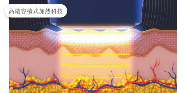 十蓓電波的高階容積式加熱科技