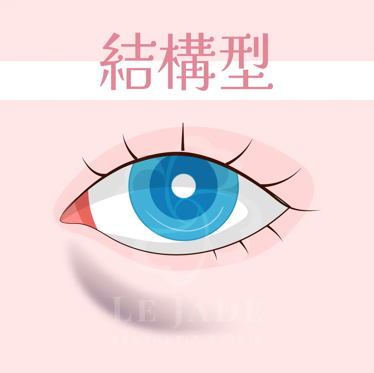 黑眼圈,黑眼圈治療,黑眼圈醫美,黑眼圈治療,黑眼圈消除