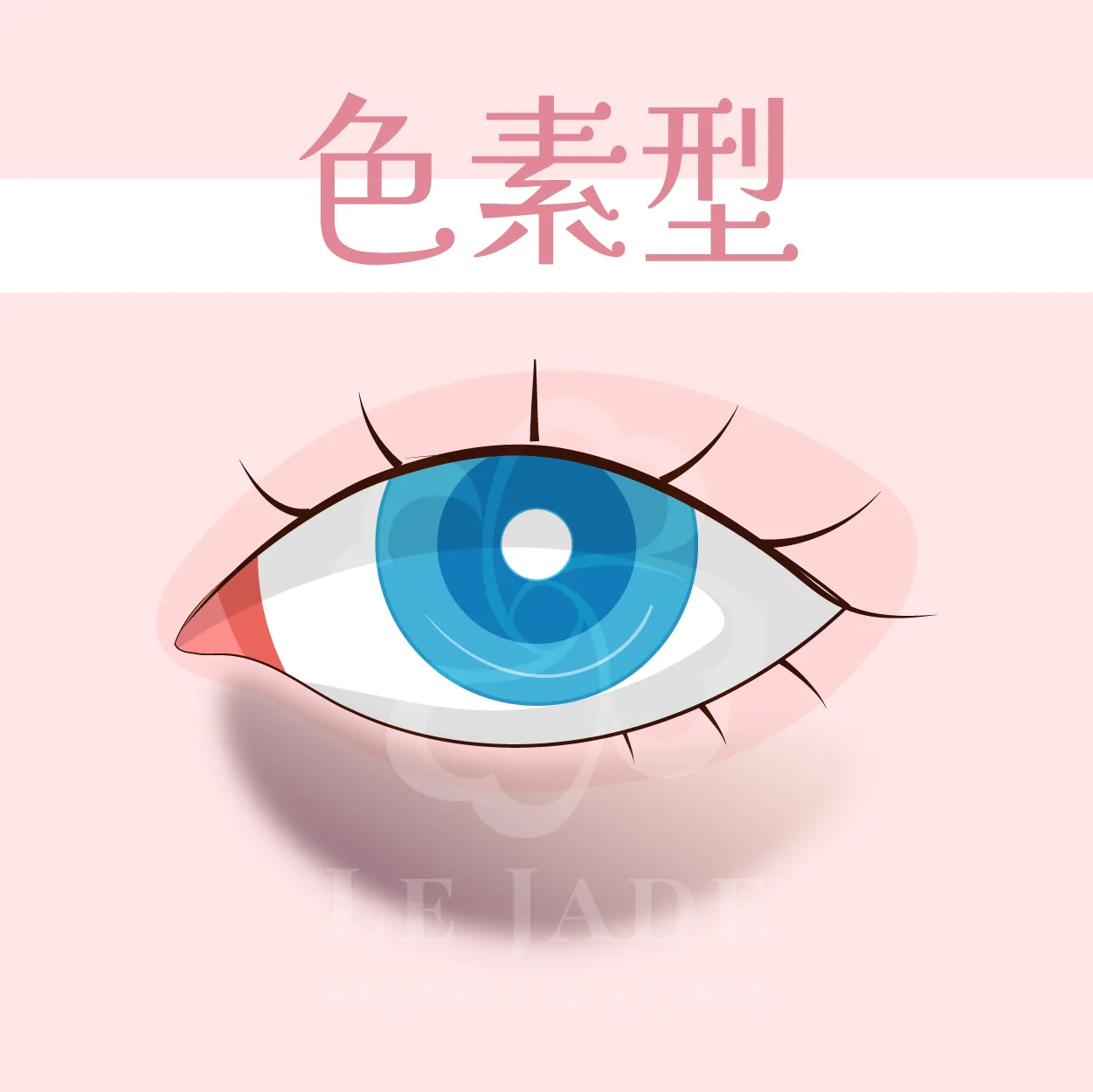 黑眼圈,黑眼圈治療,黑眼圈醫美,黑眼圈治療,黑眼圈消除