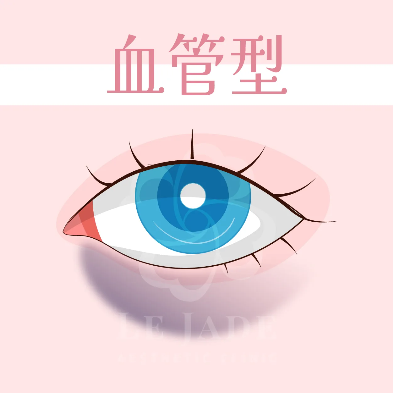 黑眼圈,黑眼圈治療,黑眼圈醫美,黑眼圈治療,黑眼圈消除